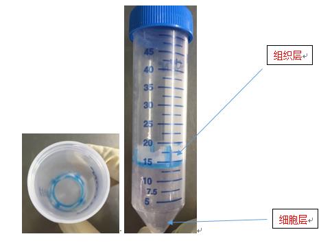 高效细胞组织分离滤管